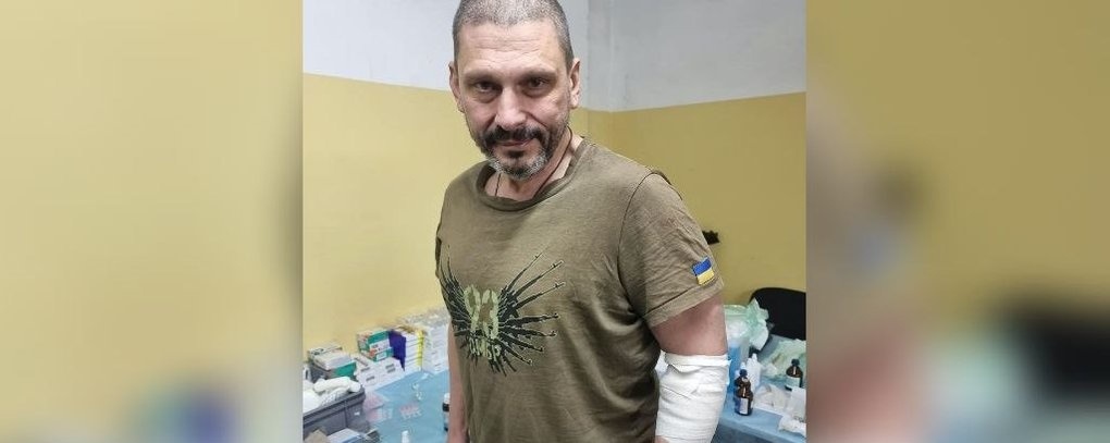 Зважаючи на ситуацію, почуваюся нормально, я можу робити сюжети і можу знімати, через пару тижнів я сподіваюсь повернутися до роботи. Потрібно повторити спробу – все-таки потрапити у Чернігів. Це дуже важливо.