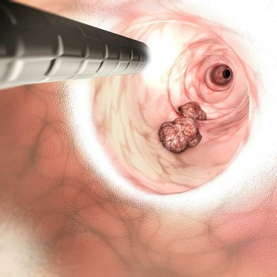 https://www.lissod.com.ua/ua/prevention/good-to-know/colonoscopy-gastroscopy/