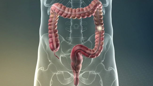 https://www.lissod.com.ua/ua/prevention/good-to-know/colonoscopy-gastroscopy/